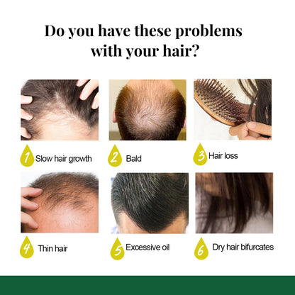Ginger Hair Growth Spray