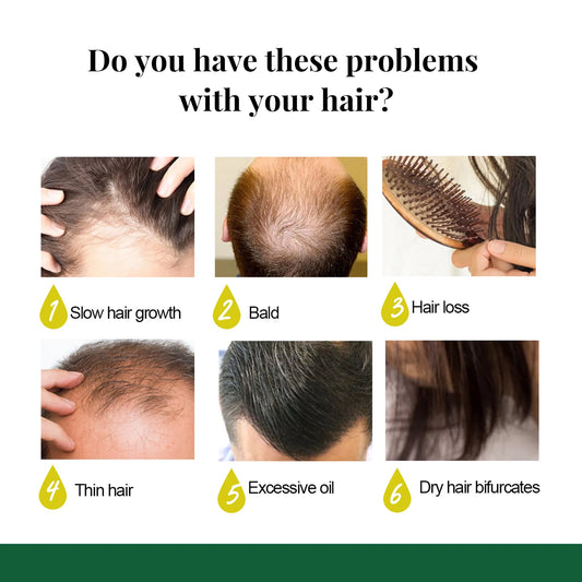 Ginger Hair Growth Spray